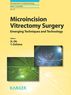 cover image of Microincision Vitrectomy Surgery